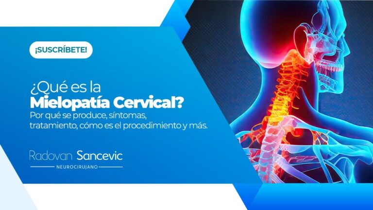 Mielopatía cervical: Una guía sobre la incapacidad permanente